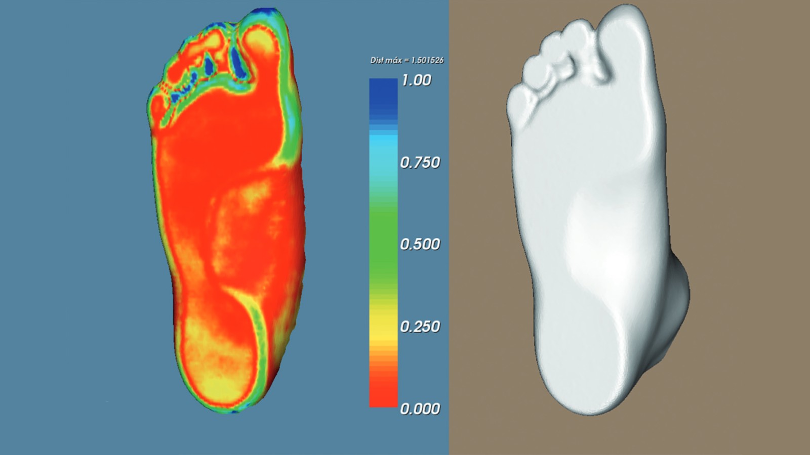Imagen térmica e imagen en 3D de la planta de un pie usando Shapescan