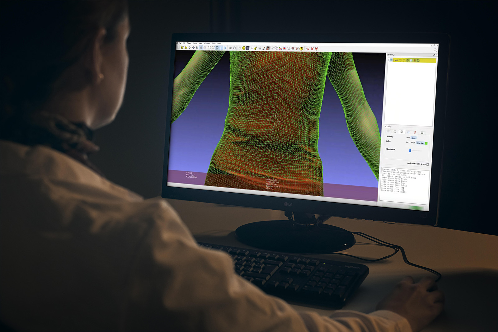An IBV operator looking the result of the Move 4D scan