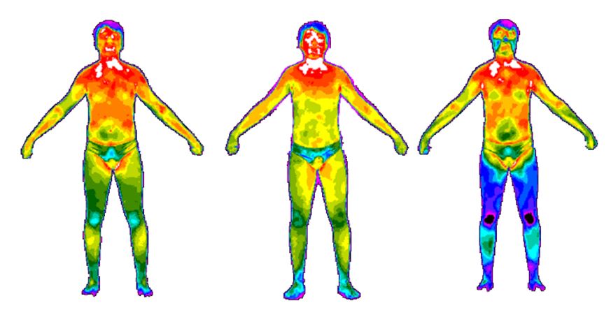 Imágenes térmicas de cuerpo humano para el proyecto COPET