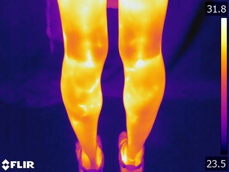 Medición térmica de unas piernas