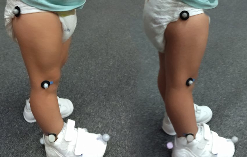 Imagen de las piernas de un bebé que participa en el estudio del proyecto Biomechanics
