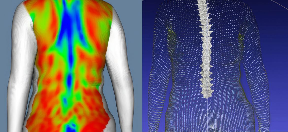 Imagen_proyecto_FSPINE-ColumnaVertebral